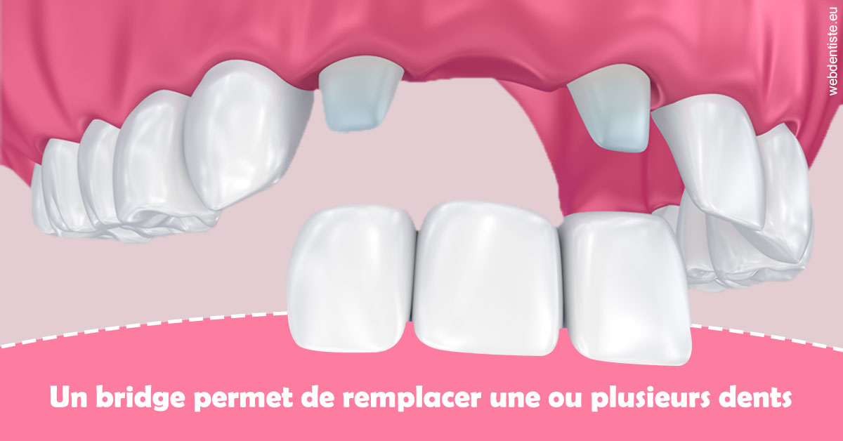 https://selarl-cabinet-orthodontie-mh-preve.chirurgiens-dentistes.fr/Bridge remplacer dents 2