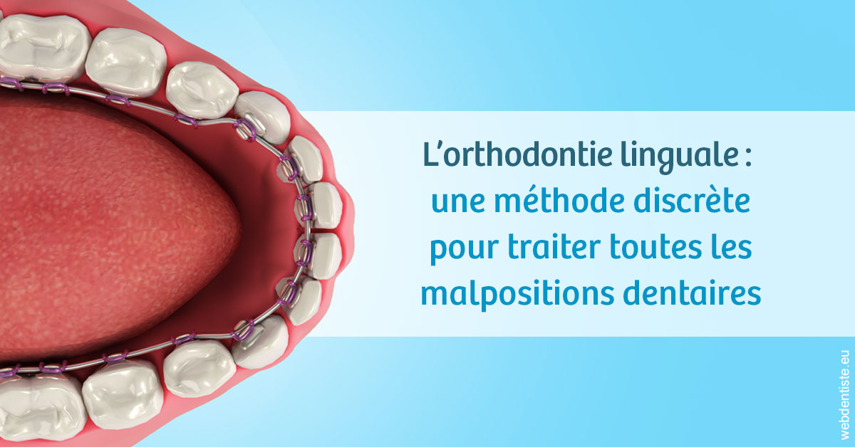 https://selarl-cabinet-orthodontie-mh-preve.chirurgiens-dentistes.fr/L'orthodontie linguale 1