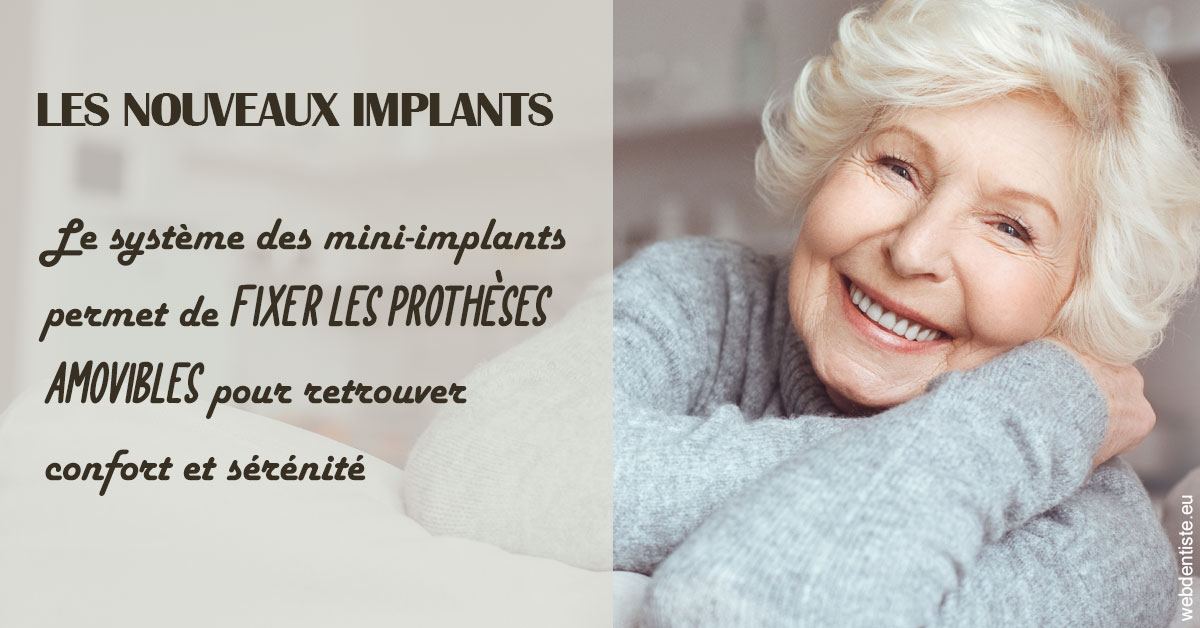https://selarl-cabinet-orthodontie-mh-preve.chirurgiens-dentistes.fr/Les nouveaux implants 1
