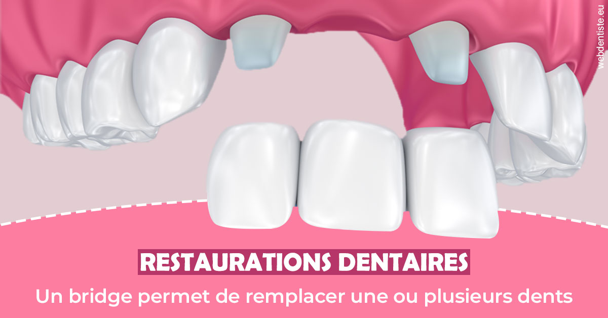 https://selarl-cabinet-orthodontie-mh-preve.chirurgiens-dentistes.fr/Bridge remplacer dents 2