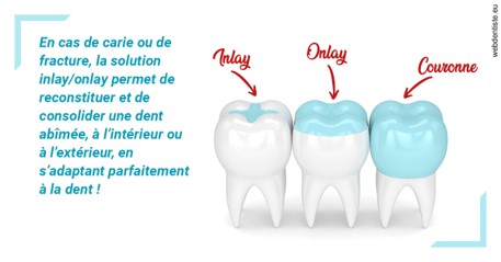 https://selarl-cabinet-orthodontie-mh-preve.chirurgiens-dentistes.fr/L'INLAY ou l'ONLAY
