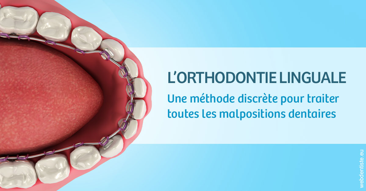 https://selarl-cabinet-orthodontie-mh-preve.chirurgiens-dentistes.fr/L'orthodontie linguale 1