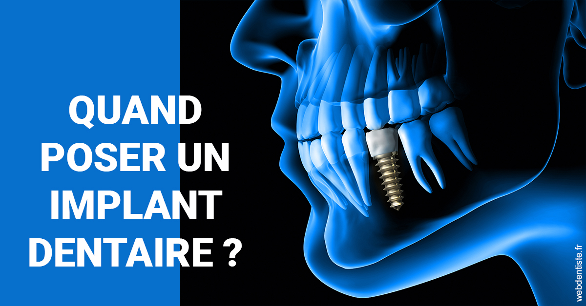 https://selarl-cabinet-orthodontie-mh-preve.chirurgiens-dentistes.fr/Les implants 1