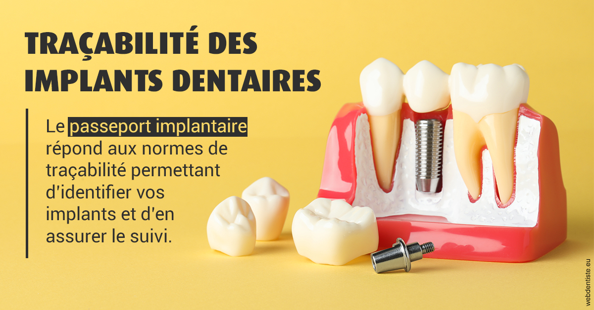 https://selarl-cabinet-orthodontie-mh-preve.chirurgiens-dentistes.fr/T2 2023 - Traçabilité des implants 2