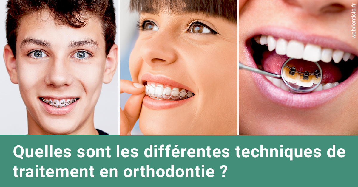 https://selarl-cabinet-orthodontie-mh-preve.chirurgiens-dentistes.fr/Les différentes techniques de traitement 2