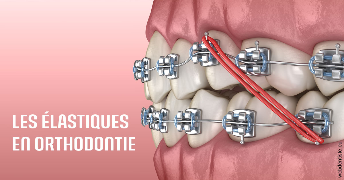 https://selarl-cabinet-orthodontie-mh-preve.chirurgiens-dentistes.fr/Elastiques orthodontie 2
