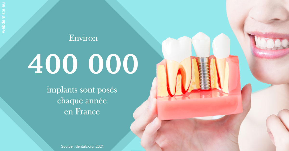 https://selarl-cabinet-orthodontie-mh-preve.chirurgiens-dentistes.fr/Pose d'implants en France 2