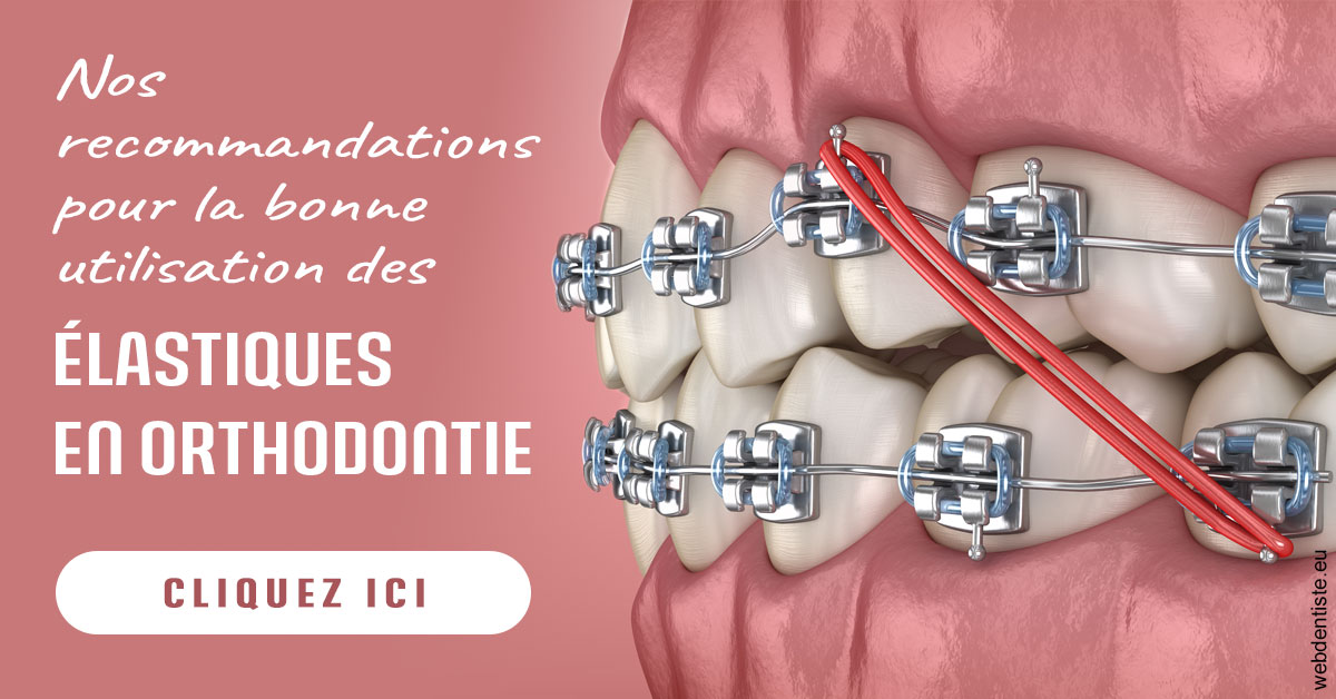 https://selarl-cabinet-orthodontie-mh-preve.chirurgiens-dentistes.fr/Elastiques orthodontie 2